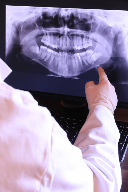 Best Broken Tooth Emergency  in Mount Vernon, GA
