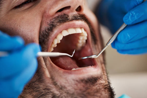 Best Emergency Tooth Extraction  in Mount Vernon, GA