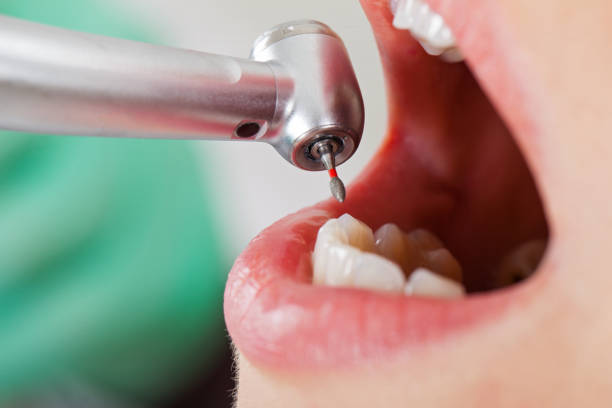 Best Cracked Tooth Emergency Dentist  in Mount Vernon, GA